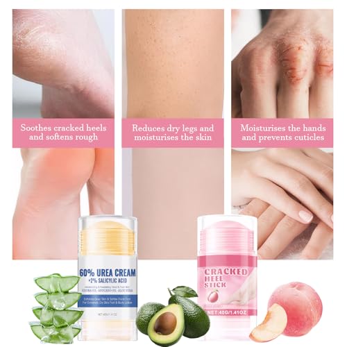 Fusspflege Creme 2 Stück Anti-Cracking Fußcreme Feuchtigkeitsspendend und Risshemmend Foot Cream Stick, Urea Repair Plus Fußcreme Zur Linderung Extrem Trockener und Rissiger Füße – Bild 6