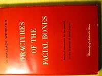 Fractures of the Facial Bones 0803201915 Book Cover