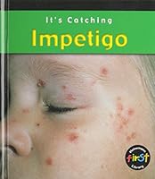 Impetigo (It's Catching) 1403402744 Book Cover