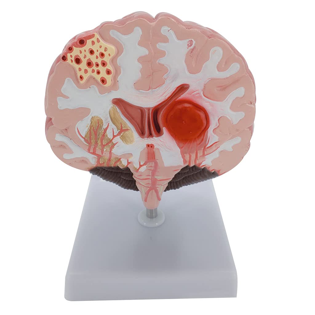 RBRMHM Human Model Anatomical Model with Cerebral Arteries for Education Lectures Use