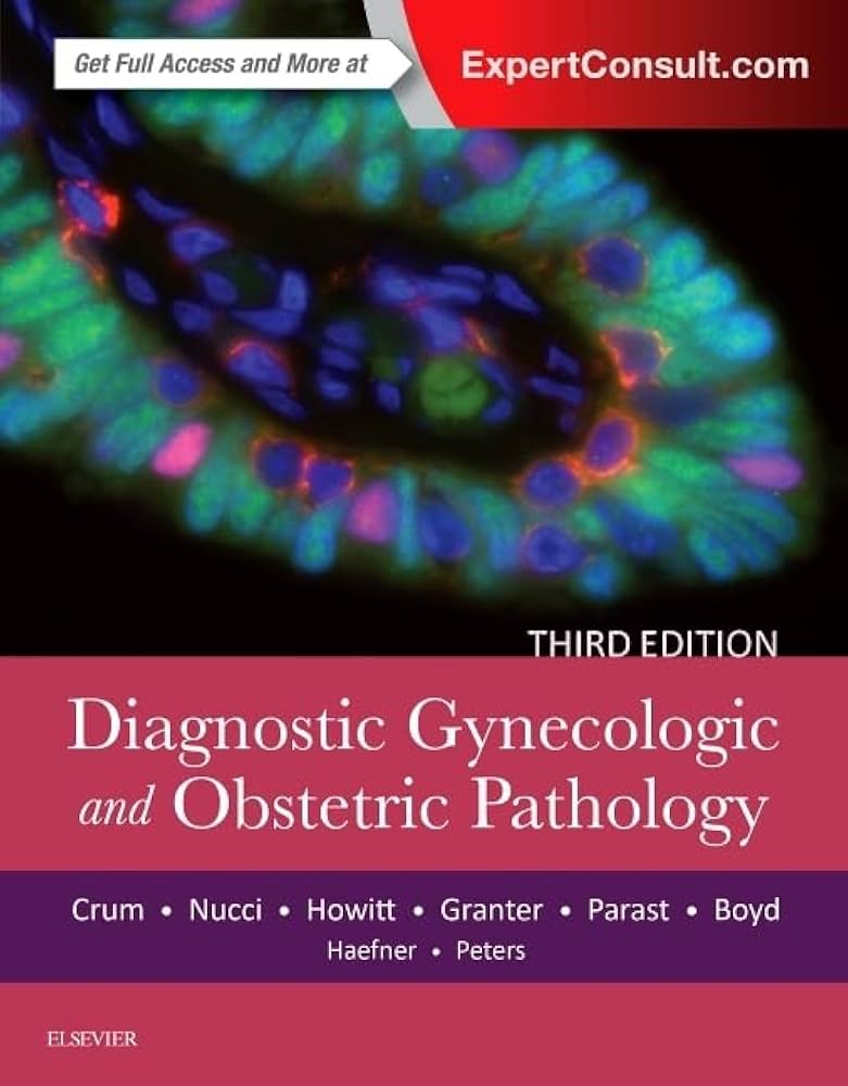 語学+参考書 Diagnostic Pathology: Gynecological 615j+13B1SS.jpg_BO30,255,255,
