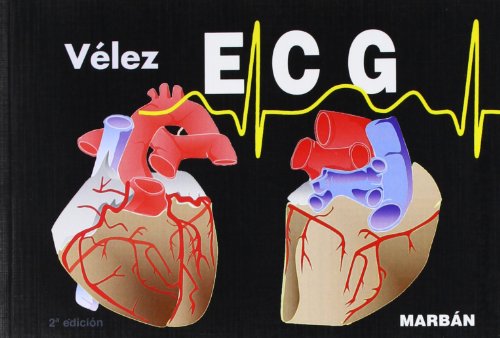 ECG, pautas de electrocardiografía