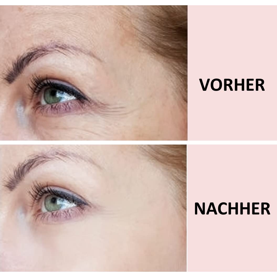 2 St. Stirn & Zornesfalte Anti Falten Pad + GRATIS AUGENPADS I bis zu 30x wiederverwendbar I Anti-Falten Pads zur Glättung & Reduktion von Stirnfalten I Forehead Pad | SCHNELLE WIRKUNG
