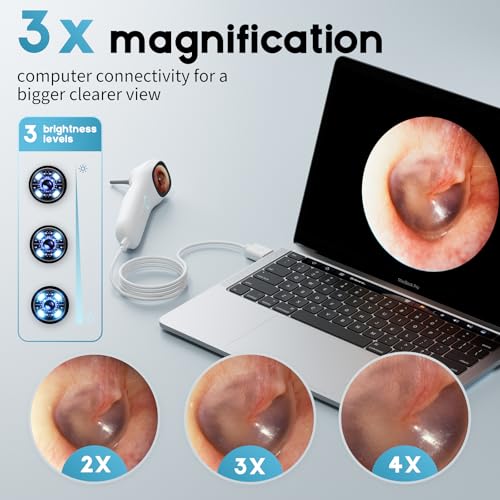 Image of Otoscope Ear Camera with 1.21 inch Screen, 1080P Ear Scope with 4 LED Lights, Otoscope Camera for Adults, Support Photo & Video, Type-C Charging with Computers, Baby Essentials, Home Medical | 1.21 inch Screen for real-time viewing. Capture photos and videos, Connect to PC, Type-C rechargeable.