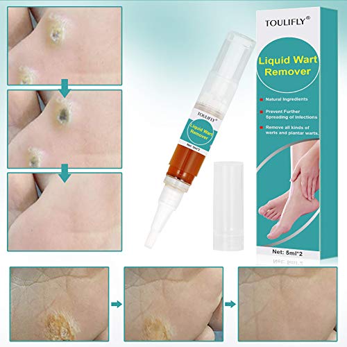 Wart Remover,Foot Wart Remover,Plantar Wart Remover,Wart Remover Liquid Pen Corn Callus Remover Liquid for Common Warts Plantar Corn Callus Stops Wart Regrowth