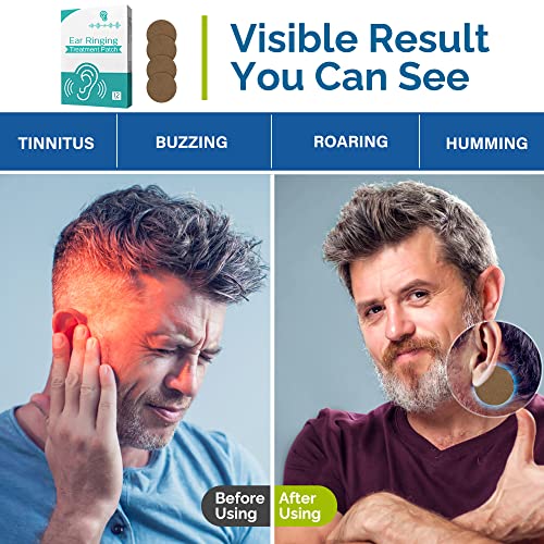 Tinnitus Relief Patches, Tinnitus Relief For Ringing Ears, Natural Herbal Formulation Tinnitus Treatment Patches For Hearing Loss & Eār_Āche Relieves, Improves Hearing & Boost Blood, 12 Pcs #TOP5