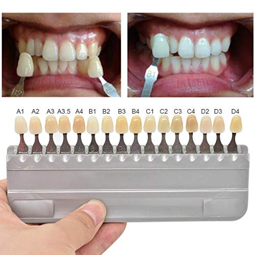 Smiledt 3D Teeth Whitening Shade Guide Porcelain - 16 Colors/Set Tooth Bleaching Shade Chart Mold - Tracking & Comparing - Dental Material Equipment - Oral Care #TOP3