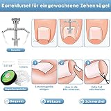 Modacraft zestaw 7 sztuk profesjonalnych cążek do paznokci stóp, superostre, wysokiej jakości stal nierdzewna, zestaw do pedicure, do grubych wrastających paznokci, sprawdzi się w przypadku grzybicy paznokci
