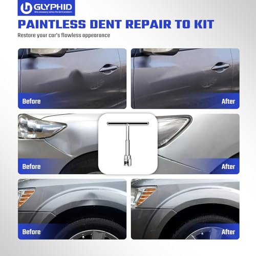 GLYPHID 28Pcs Dent Repair Kit