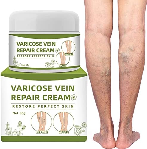 Varicose Veins Cream, Spider Veins Repair Cream, Varicose Vein Treatment for Legs (50g)
