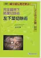 完全鏡視下肺葉切除術 DVD 完全鏡視下肺葉切除術 左上葉切除術 [DVD] | 宮本好博 |本