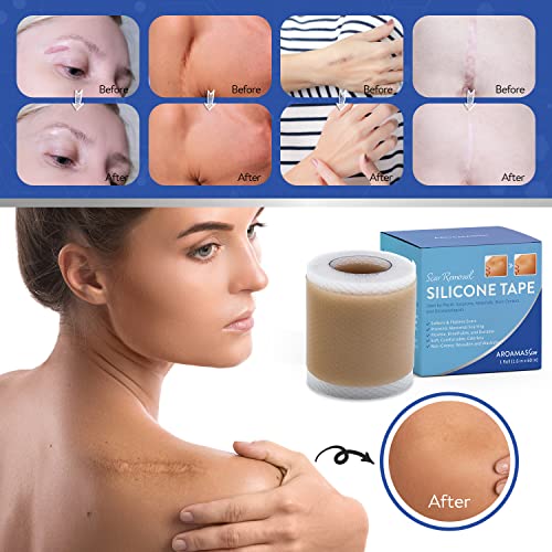 Image of Aroamas Scar Silicone Scar Sheets Scar Removal Silicone Scar Tape 1.6x60 inch for Softening and Flattening Scars, Acne, C-Section, Keloid Surgery, Painless Removal, Reusable, Washable, 6-8 Month Supply