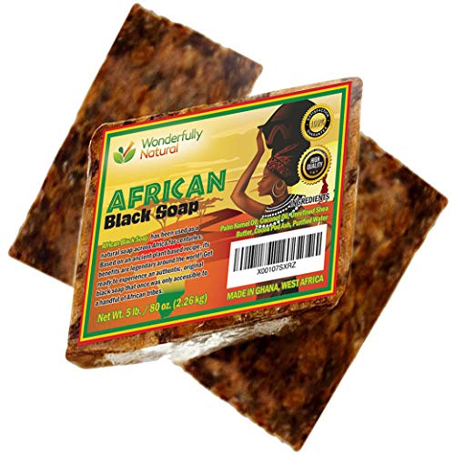 Organic-African-Black-Soap-5-Pound-Best-for-Acne-Eczema-Dry-Skin-Psoriasis-Scars-Dermatitis-White-Heads-Pimples-Face-Body-Wash-Raw-Handcrafted-Beauty-Scrub-Bar