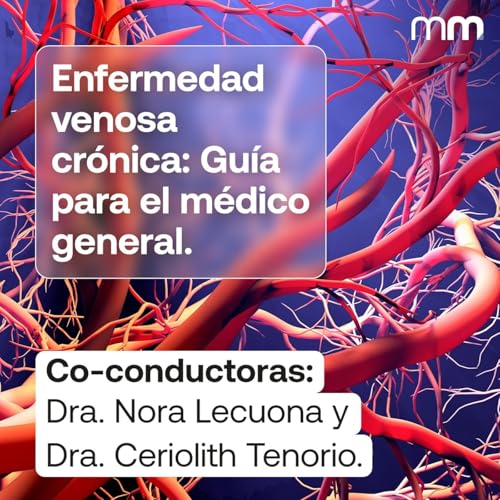 Enfermedad Venosa Cr&oacute;nica: Gu&iacute;a para el M&eacute;dico General.