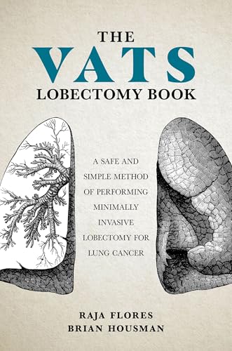 The VATS Lobectomy Book: A Safe and Simple Method of Performing Minimally Invasive Lobectomy for Lung Cancer