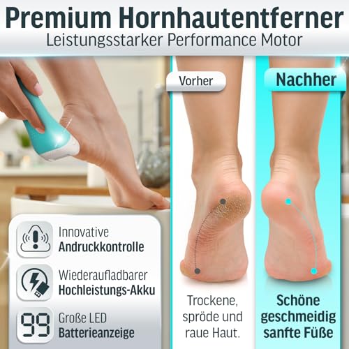 Grundig Hornhautentferner elektrisch Pro - schnell Hornhaut entfernen ohne Bücken - Premium Akku Hornhaut Entferner nass + trocken mit Arbeitslicht, 3 Fuß Rollen, wiederaufladbar (Hornhautentferner)