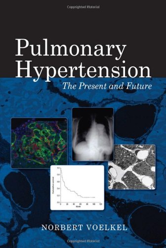 Buy Pulmonary Hypertension: The Present and Future (AGENCY/DISTRIBUTED) — BookShops.in
