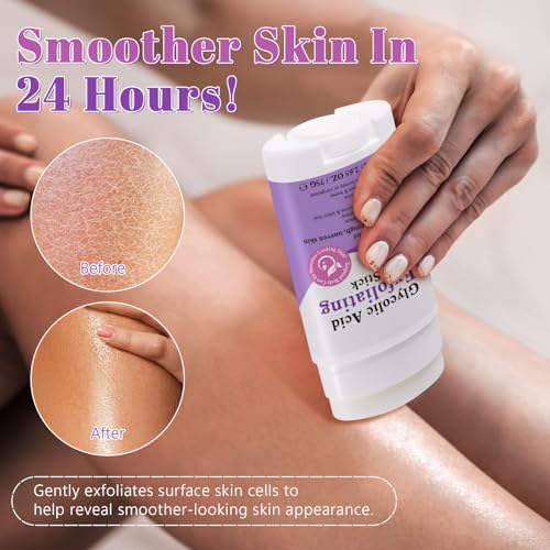XINSZLIN Glycolic Acid Exfoliating Body Stick with 7% AHA & 0.5% BHA – Solid Body Exfoliator for Rough & Bumpy Skin, KP, Dark Spots – No Mess, No Rinse – With Shea Butter