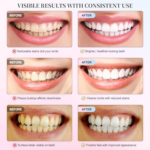 Image of Niacinamide Whitening Toothpaste, 2 Pack Intensive Stain Removal Toothpaste for Yellow Teeth, Gum Care, Fresh Mint & Peach Breath, Tartar Control, Deep Clean for Men and Women, 3.5oz