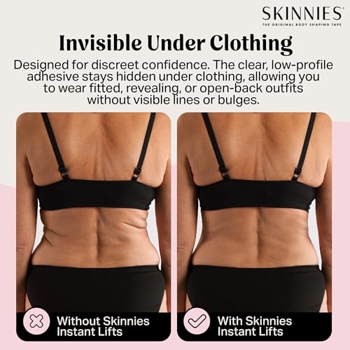 Skinnies Instant Back Lift Tape - Patented & Made in USA - Smooths Back Fat Instantly - Hides Easily on Your Sides - Waterproof, Clear Adhesive Strips, Sweatproof Body Tape for Women - 5 Pairs3