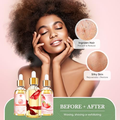 Image of Yoni Oil for Women 3 PCS Feminine Oil for pH Balance-Rose&Strawberry&Peach | Feminine Oil Vaginal Moisturizer - Reduces Odor, Restores pH Balance, Helps with Vaginal Itch 1 fl oz /pcs