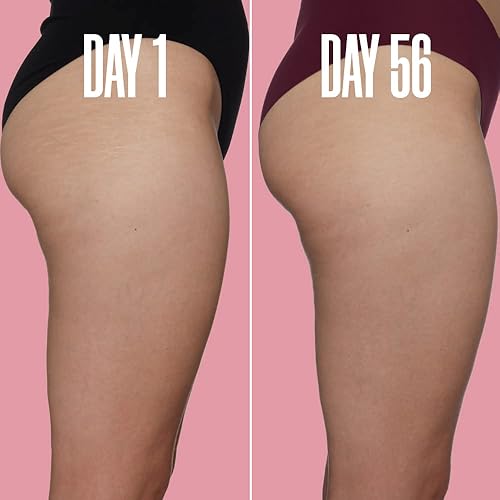 Miniatura 9 de MAELYS THE THIGH & BELLY STRETCH MARK DUO