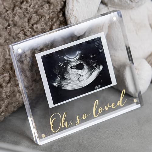 Image of Ultrasound Picture Frames - Newborn Photo & Sonogram Picture Frame - Modern Custom Baby Sonogram Frame - Early Pregnancy Must Haves First Trimester Pregnancy Essentials Ultrasound Frame - Baby Sonogram Picture Frame - Ultrasound Photo Frame