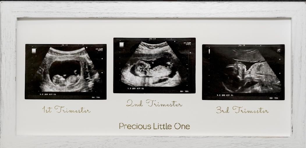 Rustic White Ultrasound Picture Frame for Baby Nursery with Sonogram Display for 1st, 2nd, 3rd Trimester Photos, Farmhouse Pregnancy Keepsake, Mom to be Gift, Gender Reveal Party Picture Collage