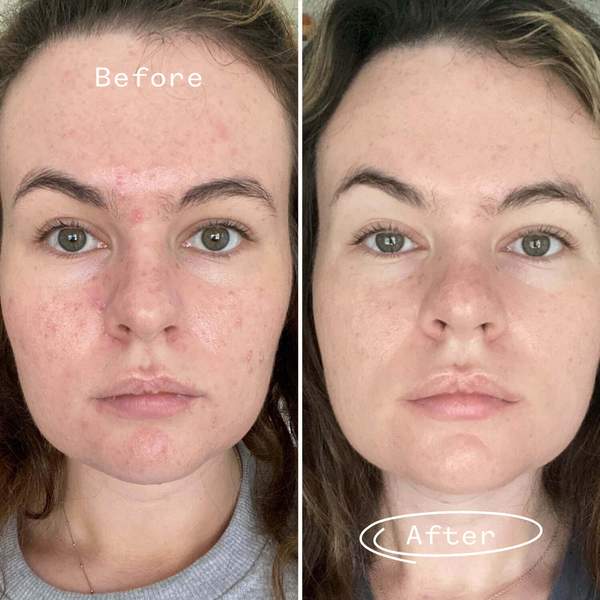 PAI SKINCARE - Organic Carbon Star Detoxifying Overnight Face Oil | Natural, Vegan, Sensitive Skincare (1 fl oz | 30 ml) - Image 4