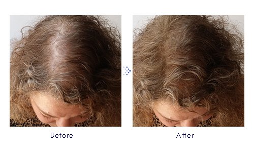 Miniatura 7 de Forila Corrector de pérdida de cabello de fibras de construcción de cabello, 0.81 oz - marrón oscuro