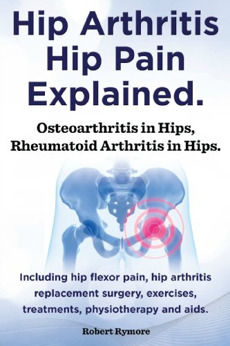 Hip arthritis, hip pain explained. Osteoarthritis in hips, rheumatoid arthritis in hips. Including hip arthritis surgery, hip flexor pain, , exercises, treatments, physiotherapy and aids.