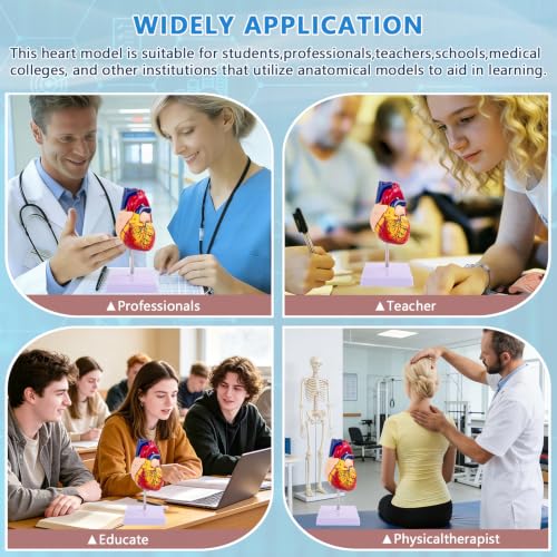 Image of 1:1 Life-Size Human Heart Model with 34 Numbered Anatomical Markers,2-Part Detachable Heart Anatomy Model for Education, Cardiology Study, Patient Demonstration