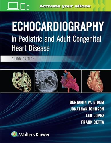 Amazon | Echocardiography in Pediatric and Adult Congenital Heart ...