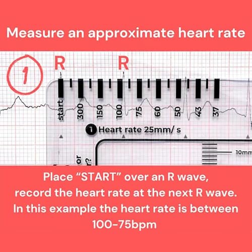 Regla ECG 7 Pasos Transparente de Plástico para Interpretar ECG miniatura 2
