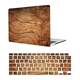 【Installation et utilisation】L'étui pour ordinateur portable est conçu en deux parties et s'enclenche. Il n'est pas nécessaire d'utiliser d'autres outils pour l'installer, il suffit d'aligner les quatre coins de l'ordinateur portable et d'appuyer doucement. Vous pouvez accéder à tous les ports, y compris le chargement et l'utilisation du casque, sans retirer l'étui lorsque vous utilisez le Macbook. L'étui n'interfère pas avec le fonctionnement de l'ordinateur portable.