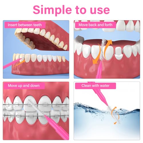 Image of Healeved 100PCS Braces Brushes Interdental Brushes Braces Flossers Braces Brush for Cleaner Toothpick Dental Flossing Head Oral Flosser Dental Picks for Teeth Cleaning(5colors)