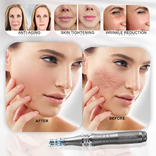 Tennessee-essentials-Dr-pen-M8-W-microneedling-pen-with-5-sets-of-2pcs-16-pins-2pcs-36-pins-1pcs-Nano-pin-cartridges-adjustable-size-025mm-to-25mm-Microneedle-Dermapen-for-Face-Body-Home-Use