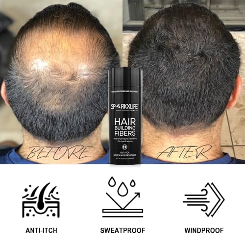 Image of Hair Fiber Medium Brown - Keratin Thick Fiber & Hair Building Fibre for Men & Women - Instant Concealer & Filler powder for Thinning Hairline & Bald Spots (27.5g) (Medium Brown)