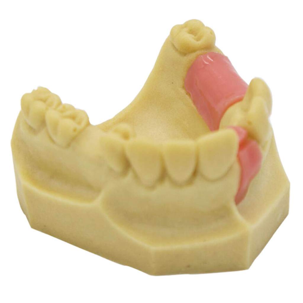 Zęby Model Denture Repair Sadzenie Szkolenia Żywicy Materiał Medyczny Pomoc Szkoleniowa Medyczna