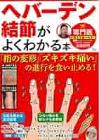 ヘバーデン結節がよくわかる本 「指の変形」「ズキズキ痛い」の