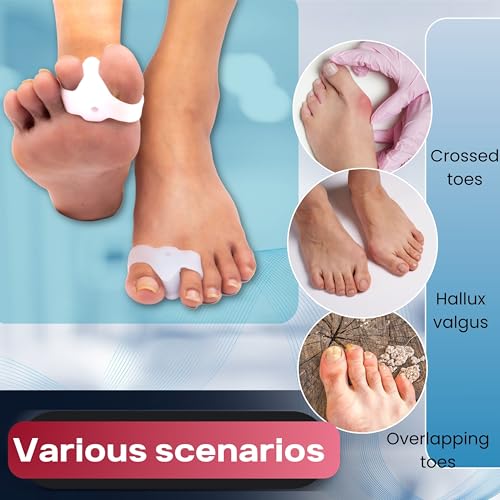 Image of Wonder Care Silicone Toe Separator For Feet Gel Pads Big Toe Corrector Bunion Straightener Yoga Stretcher Hammer Bunion [Pair of 1-2 Pieces]