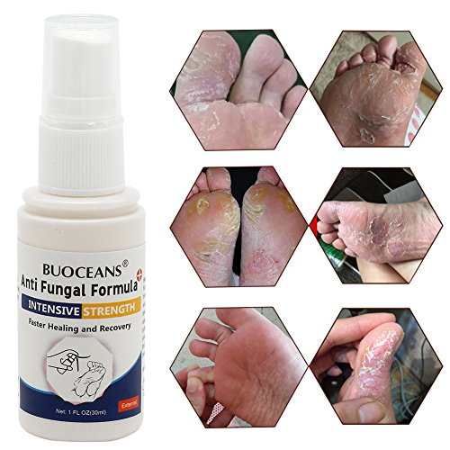 Antifungal Spray, Anti Fungal Foot spray, Natural formula ,Athletes