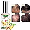 Hair-Growth-Oil2021-Hair-Growth-SerumHair-GrowthStops-Hair-Loss-Hair-Thinning-Treatment-Hair-Growth-TreatmentEssential-Oil-for-Women-Men-50ml Hair Growth Oil,2021 Hair Growth Serum,Hair Growth,Stops Hair Loss, Hair Thinning Treatment, Hair Growth Treatment,Essential Oil for Women Men-50ml…