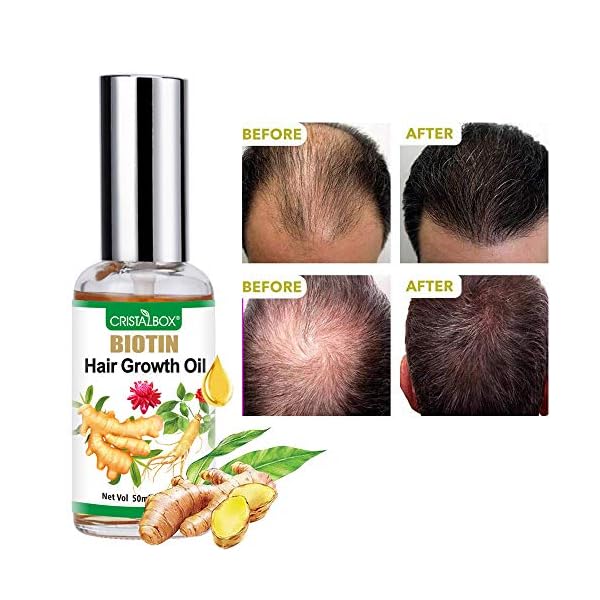 Hair-Growth-Oil2021-Hair-Growth-SerumHair-GrowthStops-Hair-Loss-Hair-Thinning-Treatment-Hair-Growth-TreatmentEssential-Oil-for-Women-Men-50ml Hair Growth Oil,2021 Hair Growth Serum,Hair Growth,Stops Hair Loss, Hair Thinning Treatment, Hair Growth Treatment,Essential Oil for Women Men-50ml…