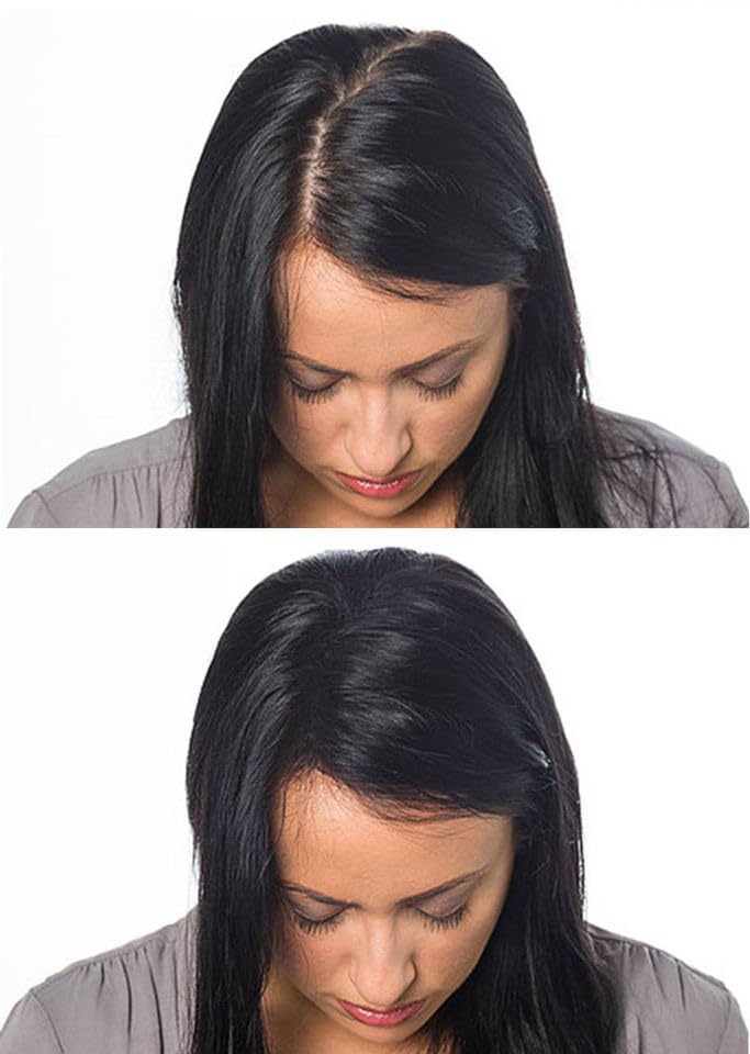 Hair Building Fibers 100% Wool - Natural Keratin. Size: 1/2 a Pound (227Grams) Bulk Refill Pack 60-80% SAVINGS. Thinning Hair/Bald Spots Toppikk, Sure Thick & Bosley. (Medium Brown, 227 grams)