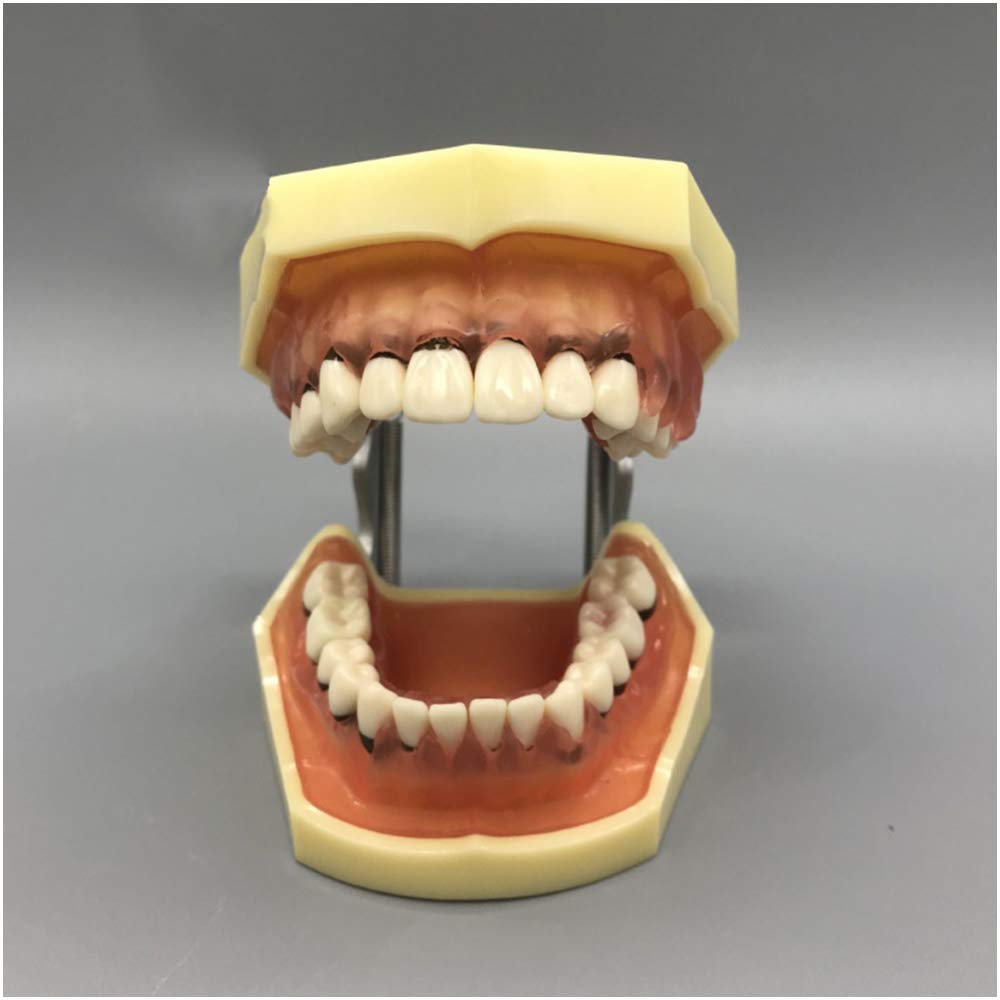 Sjdopulse A Teeth Teaching Model - Practice Dental Calculus Scaling Teeth Teaching Model - Simulation Oral Tooth Periodontal Pathology Model - For Study Teaching (A)