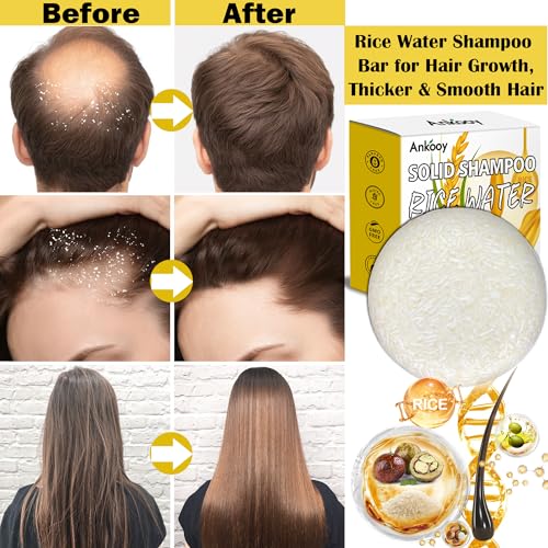 Image of Shampoo Bar,Rice Water for Hair Growth,Clarifying Shampoo for Build Up,Soap Bar,Shampoo for Thinning Hair for Women and Men,Dandruff Shampoo,Frizz Control Hair Care,Travel Shampoo,Sulfate-Free(2 Pack)