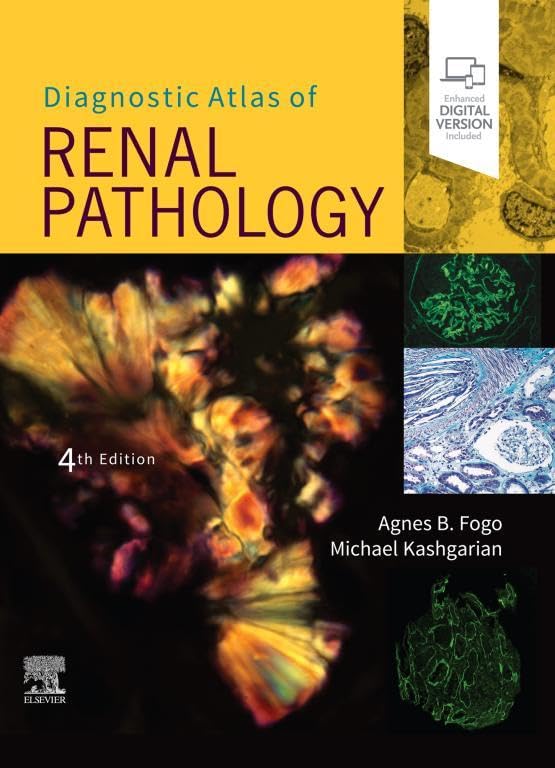 Diagnostic Atlas of Renal Pathology E-Book (English Edition)
