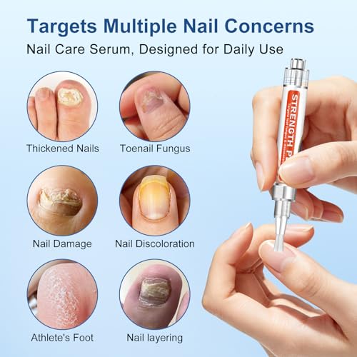 Image of Toenail Fungus Treatment Extra Strength - Fungi Nail Pen, 25% Undecylenic Acid, Fungal Nail Repair Kit for Damaged, Discolored, Yellow,Ingrown, Foot Repair Nails 5PCS