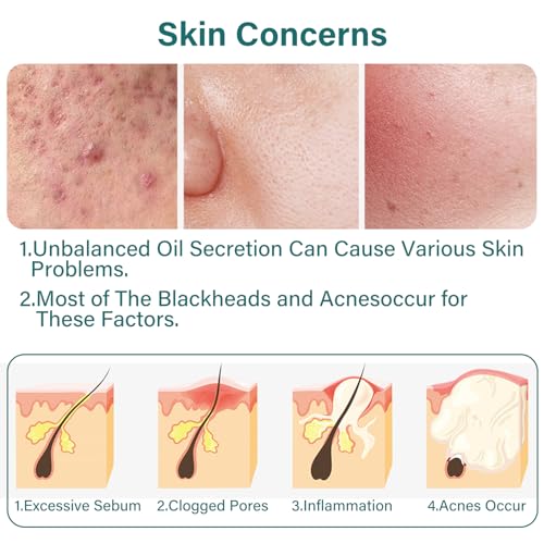 Leogony 7PCS Skincare Set for Teenagers Girls & Boys, Acne Skin Care Set for Teenage, Tea Tree Face Wash Gift for Mens Woman - Image 6